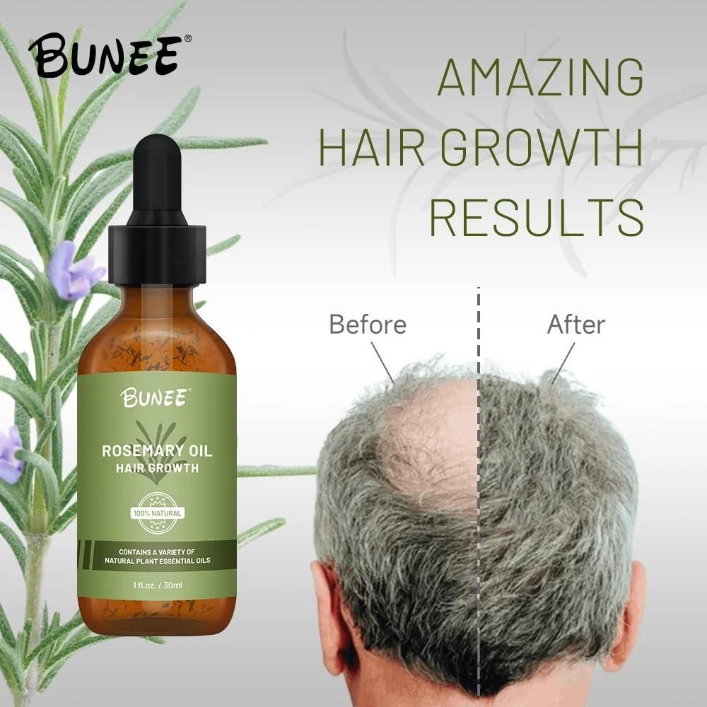 BUNEE Rosemary Hair Growth Serum Oil